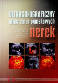 Ultrasonograficzny Atlas Zmian Ogniskowych Nerek