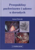 Przepukliny pachwinowe i udowe u dorosłych
