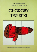 Choroby trzustki
