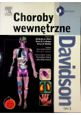 Choroby wewnętrzne Davidson Tom 1