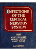 Infections of the Central Nervous System