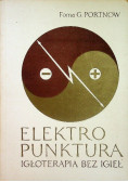 Elektro punktura igłoterapia bez igieł