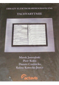 Obrazy elektrokardiograficzne tachyarytmie