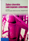Żylna choroba zakrzepowo zatorowa