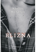 Blizna