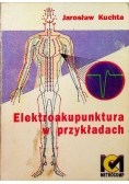 Elektroakupunktura w przykładach