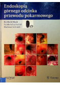 Endoskopia górnego odcinka przewodu pokarmowego