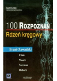100 rozpoznań Rdzeń kręgowy