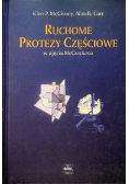 Ruchome protezy częściowe