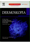 Dermoskopia