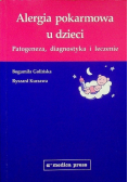 Alergia pokarmowa u dzieci