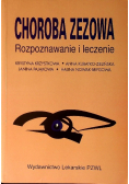 Choroba zezowa