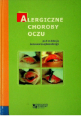 Alergiczne choroby oczu