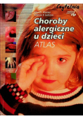 Choroby alergiczne u dzieci