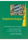 Implantologia