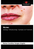 Acne