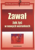 Zawał Jak żyć w nowych warunkach
