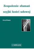 Zespolenie złamań szyjki kości udowej