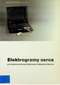 Elektrogramy serca
