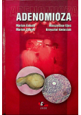 Adenomioza
