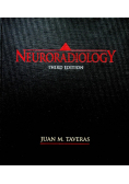 Neuroradiology Third Edition