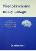 Niedokrwienne udary mózgu