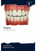 Gingiva