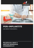 Peri-Implantite