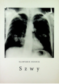 Szwy