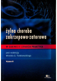 Żylna choroba zakrzepowo zatorowa