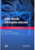 Żylna choroba zakrzepowo zatorowa