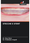 Stecche E Stent