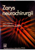 Zarys neurochirurgii