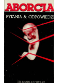 Aborcja Pytania i odpowiedzi