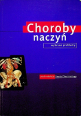 Choroby naczyń Wybrane problemy