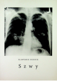 Szwy