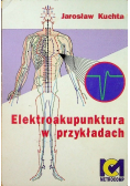 Elektroakupunktura w przykładach