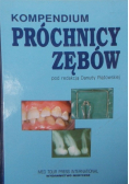 Kompendium próchnicy zębów