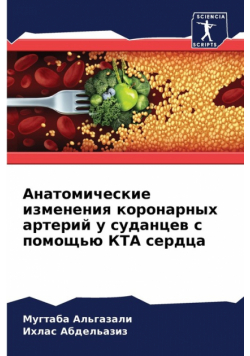 Анатомические изменения коронарных артерий у суданцев с помощью КТА сердца