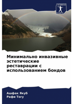 Минимально инвазивные эстетические реставрации с использованием бондов