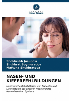 Nasen- Und Kieferfehlbildungen