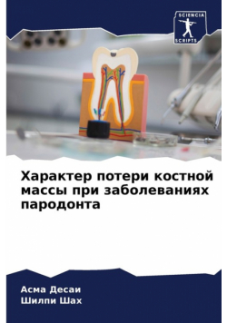 Характер потери костной массы при заболеваниях пародонта
