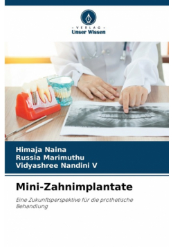 Mini-Zahnimplantate