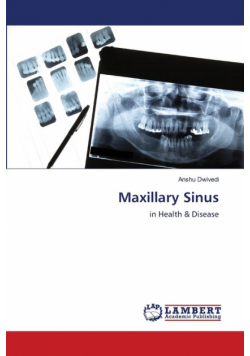Maxillary Sinus
