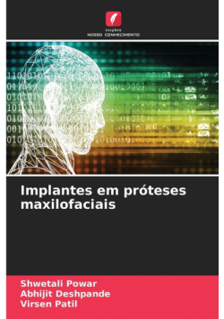 Implantes em próteses maxilofaciais