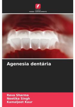 Agenesia dentária