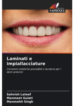 Laminati e impiallacciature