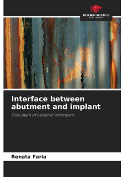 Interface between abutment and implant