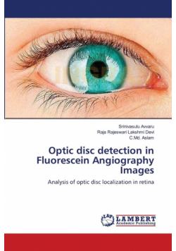 Optic disc detection in Fluorescein Angiography Images