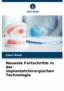 Neueste Fortschritte in der implantatchirurgischen Technologie